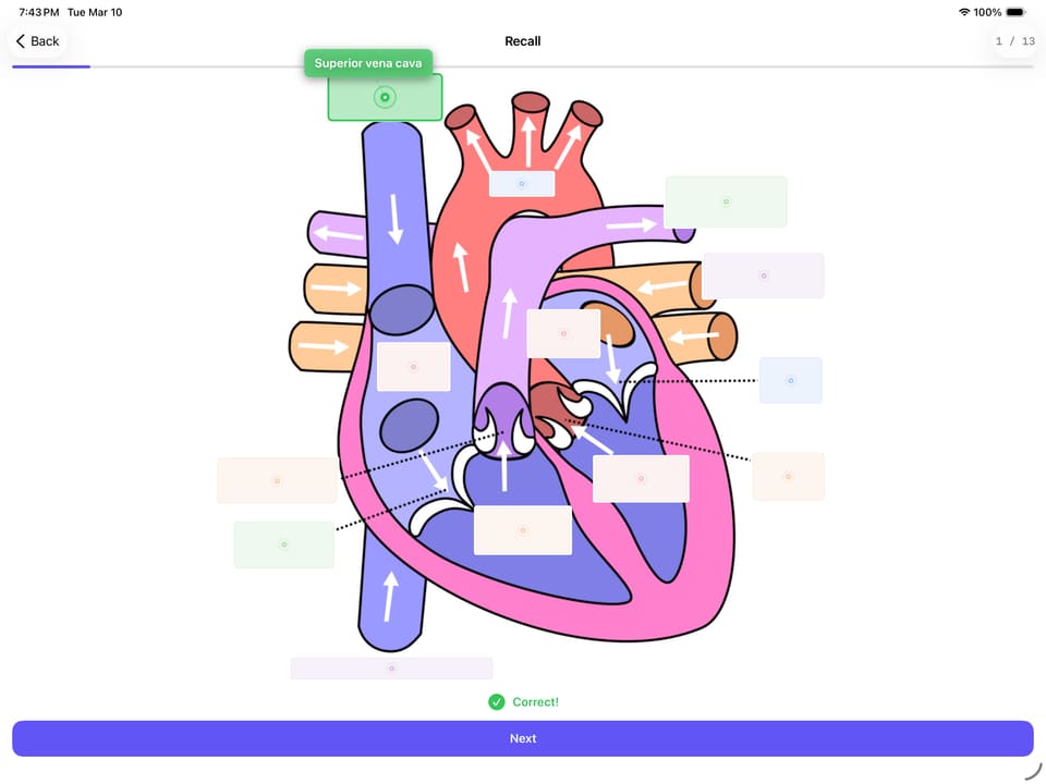 Diagram and image occlusion on iPad